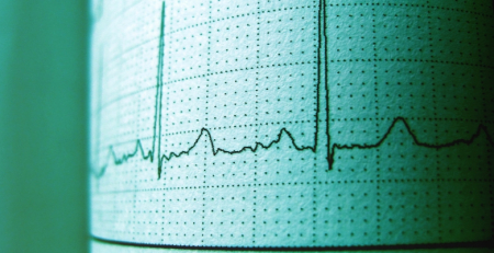 Fundação Portuguesa de Cardiologia e Becel incentivam à prevenção das doenças cardiovasculares
