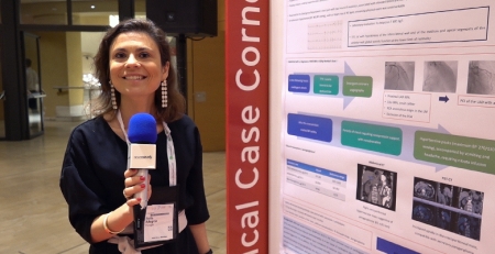 Enfarte agudo do miocárdio em choque cardiogénico: um caso clínico em destaque no Heart Failure 2019