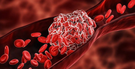 Anticoagulação em dose completa para prevenção de coágulos sanguíneos em doentes com COVID-19
