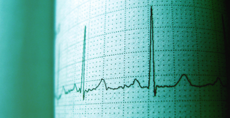 O que há de novo no guia prático da European Heart Rhythm Association para o uso de NOAC?