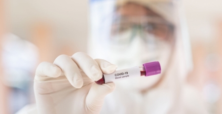 Doentes cardiovasculares sofrem mais com novo coronavírus, revela estudo